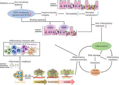 Short-Chain Fatty Acids: A Soldier Fighting Against Inflammation and Protecting From Tumorigenesis in People With Diabetes